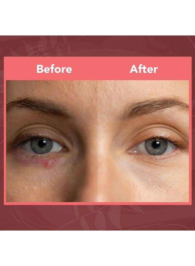 NOVEHA Extra Nove Eyelid Foaming Cleanser Daily Skincare For Eyelashes & Lids Eye Irritations Stye Eyes Skin Dryness Moisturize With Organic Ingredients For All Skin Types 3.38 Oz - Image 5