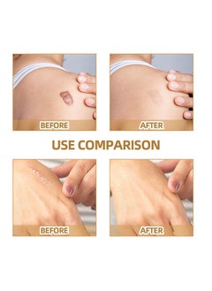 Jaysuing Tatto cover up, Ultra-Thin Flaw Concealer Sticker Patch Skin Concealing Tape, Thin tattoo cover up tape for unisex, Tattoo Cover Up Makeup Waterproof for Covering Up Scars and Tattoo 10Pcs 60 patch  - Image 5