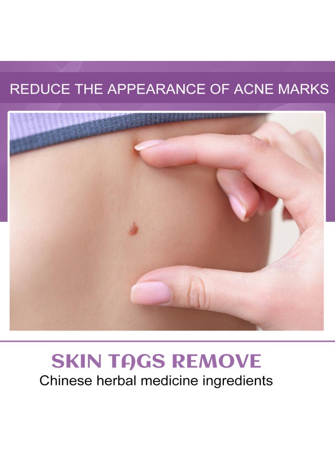 EELHOE Body Skin Care Pen Gentle Hand Foot Face Skin Cleansing Pen - Image 4