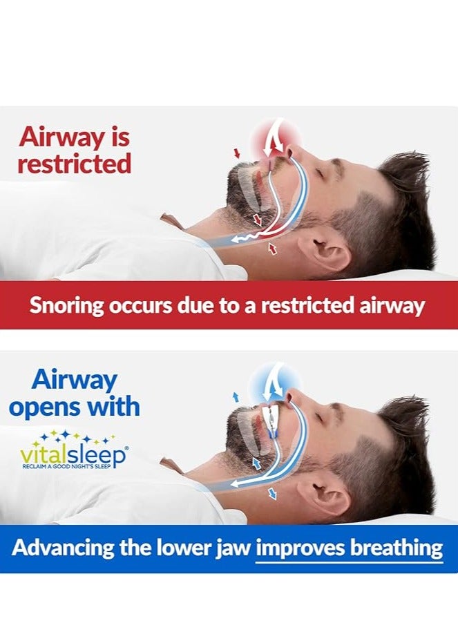 general Adjustable mouth silicone anti-snoring device night sleep aid, anti-snoring, anti-grinding braces, anti-snoring device - Image 5