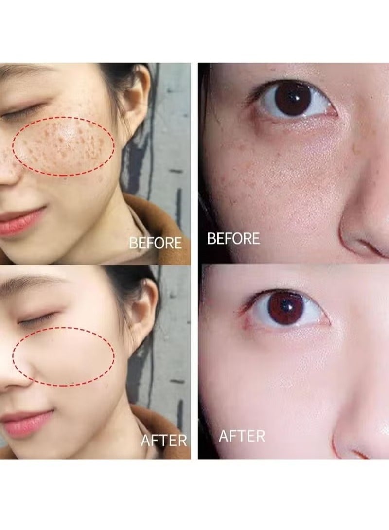 Lanthome Glutathione White Cream Facial Dark Spots Remover 2% Glutathione Face Cream Whitening Moisturizing Facial Cream Face Moisturizer Facial Skin Care Cream Intensive Lightening Facial Cream 20g - Image 5