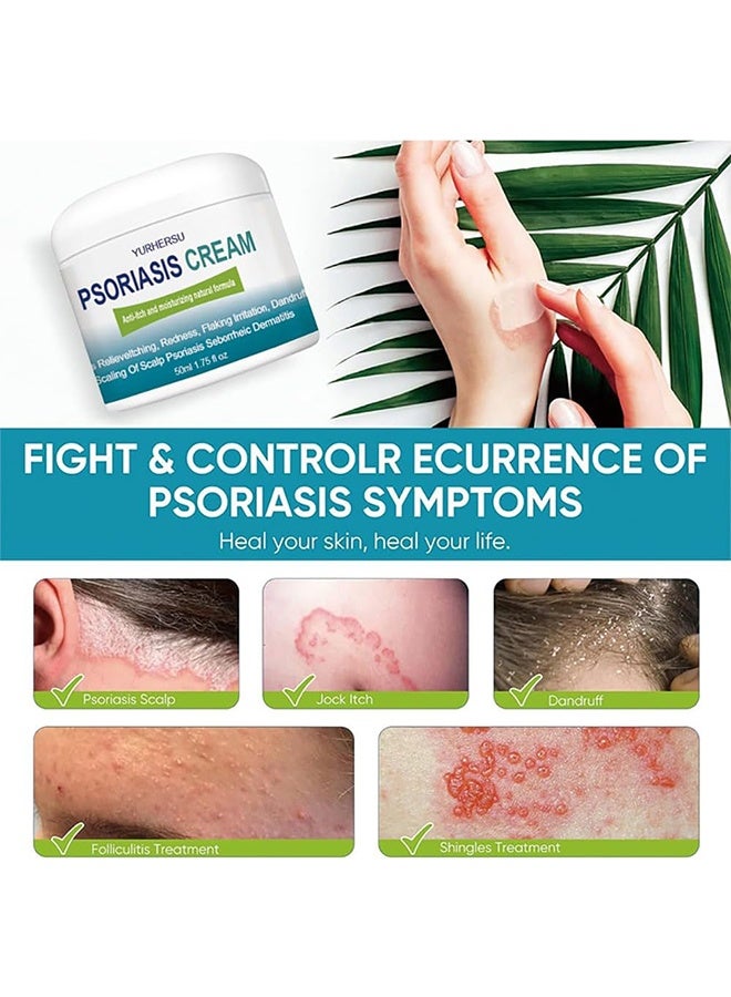YURHERSU كريم الصدفية، علاج صدفية فروة الرأس، كريم الفطريات البشرية، بلسم القدم والجسم، مضاد للحكة يساعد على تخفيف الحكة، القشرة، التهاب الجلد الدهني، مرطب، جيد للعناية اليومية بالبشرة 50 مل - Image 4