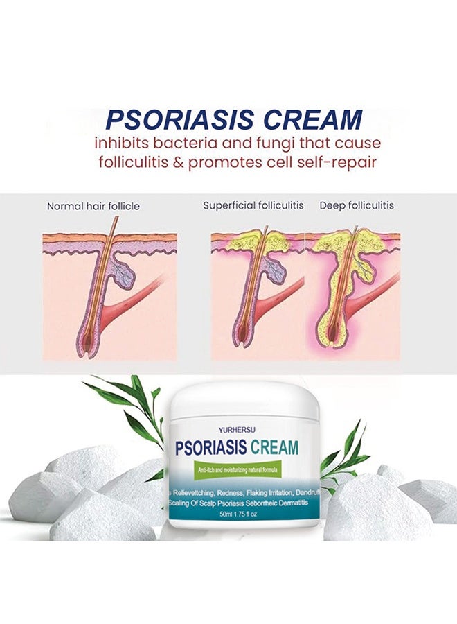 YURHERSU كريم الصدفية، علاج صدفية فروة الرأس، كريم الفطريات البشرية، بلسم القدم والجسم، مضاد للحكة يساعد على تخفيف الحكة، القشرة، التهاب الجلد الدهني، مرطب، جيد للعناية اليومية بالبشرة 50 مل - Image 3