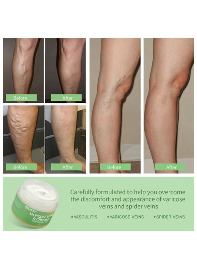 Varicose Veins Cream 50g