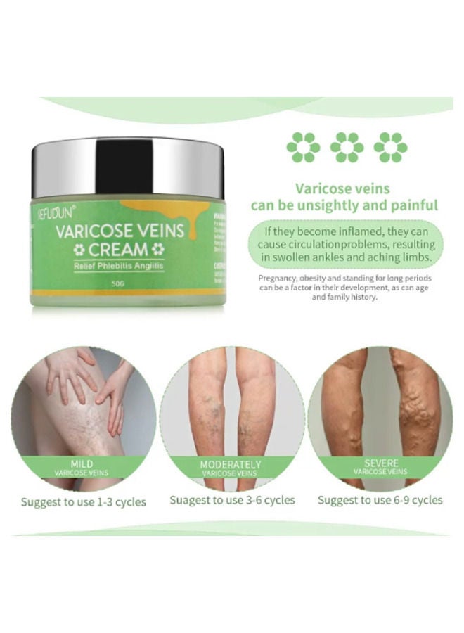 Varicose Veins Cream 50g