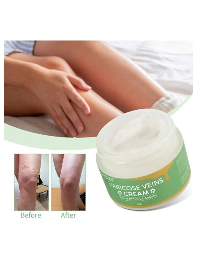 Varicose Veins Cream 50g