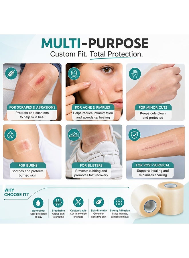 5cm x 1.5M Medical Grade Hydrocolloid Bandages Roll, Waterproof Cut-to-Fit Wound Care Tape for Wound Blisters Acne Treatment - Image 2