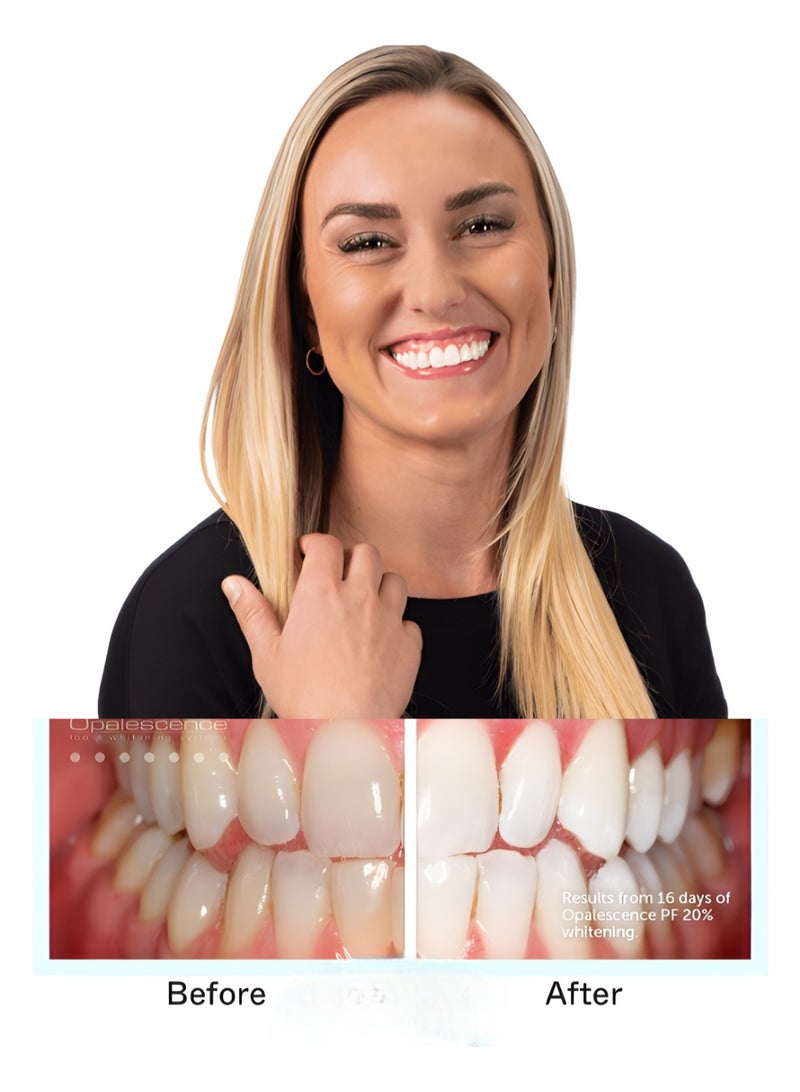 أوبال سنس جل تبييض الأسنان الأصلي ذات قوة تبيض إحترافية  تركيز 20٪ بنكهة النعناع - 8 أنابيب أزرق - Image 3