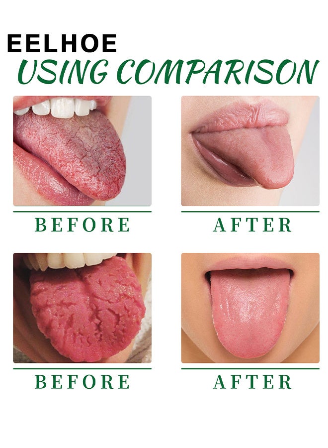 إيلهو بخاخ إصلاح اللسان ، بخاخ إصلاح الفم لإصلاح طلاء اللسان الأبيض ، بخاخ العناية باللسان ، بخاخ الفم المحمول ، بخاخ غسول الفم ، ينعش التنفس ، يزيل رائحة الفم الكريهة 30 مل - Image 5