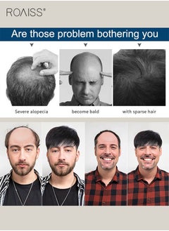 roaiss Men's Hair Natural Style Toupee, Natural Black Hair Pieces Short Wig Real Human Hair Topper Clip for Male for Covering White or Loss Hair, Hair Extensions Daily Wear (16x18cm)  - Image 3