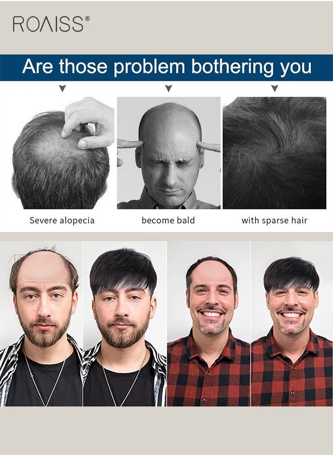 roaiss Men's Hair Natural Style Toupee, Natural Black Hair Pieces Short Wig Real Human Hair Topper Clip for Male for Covering White or Loss Hair, Hair Extensions Daily Wear (16x18cm)  - Image 3