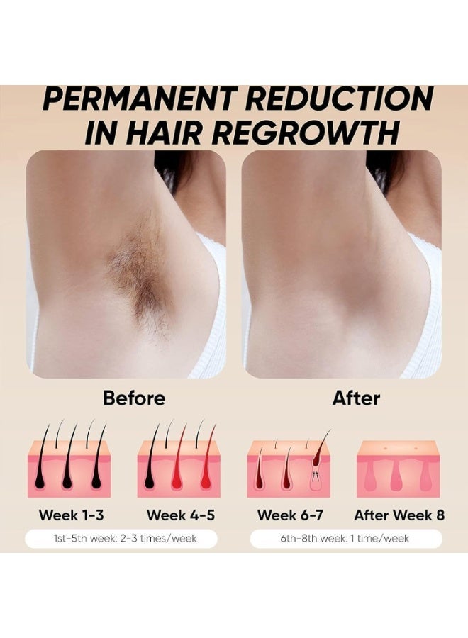 Hair Removal Handset for Women & Men – Permanent Painless Laser Epilator – At-Home Hair Remover for Face, Legs, Arms & Underarms – Professional Light-Based Hair Reduction Device - Image 5