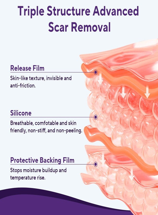 ZETRALL Silicone Scar Sheets, Silicone Scar Tape (1.6"x 60" Roll-1.5m, Advanced Scars Strips for Surgical, C-Section, Tummy Tuck, Burn, Hypertrophic, Keloid Bump Removal Treatment, Reusable - Image 5