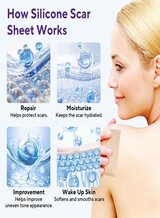 ZETRALL Silicone Scar Sheets, Silicone Scar Tape (1.6"x 60" Roll-1.5m, Advanced Scars Strips for Surgical, C-Section, Tummy Tuck, Burn, Hypertrophic, Keloid Bump Removal Treatment, Reusable - Image 4