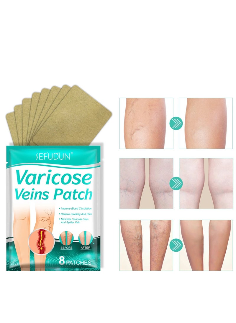 Sefudun Chinese Herbal Varicose Veins patch for Treatment Leg Pain, Relief Leg Pain Varicose Veins Patch  - Image 4