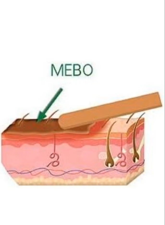 Julphar Mebo Original Ointment for Treating Burns and Wounds 100% Natural Ointment that Helps with Natural Healing and Treatment of Burns, Wounds and Skin ULCers 15 grams - Image 5