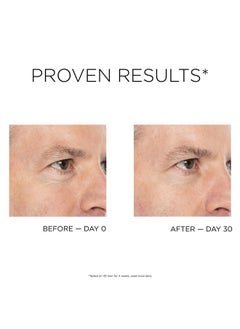 IDC Dermo Men G2 Allinone Anti Aging Face Cream Serum For Men 1 Fl Oz Anti Wrinkle Face Eyes And Neck Firming And Tightening Cream Vegan Hydrating Face Serum Anti Wrinkle Pore Refining  - Image 4