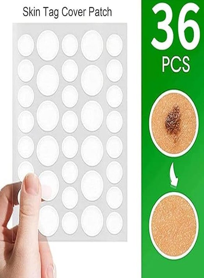 FLIZZOW Pimple Patch, Hydrocolloid Acne Dots, 36 Patches, Skin Tag Cover for Face, All Skin Types - Image 2