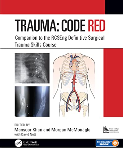 Trauma Code Red Companion To The Rcseng Definitive Surgical Trauma Skills Course 