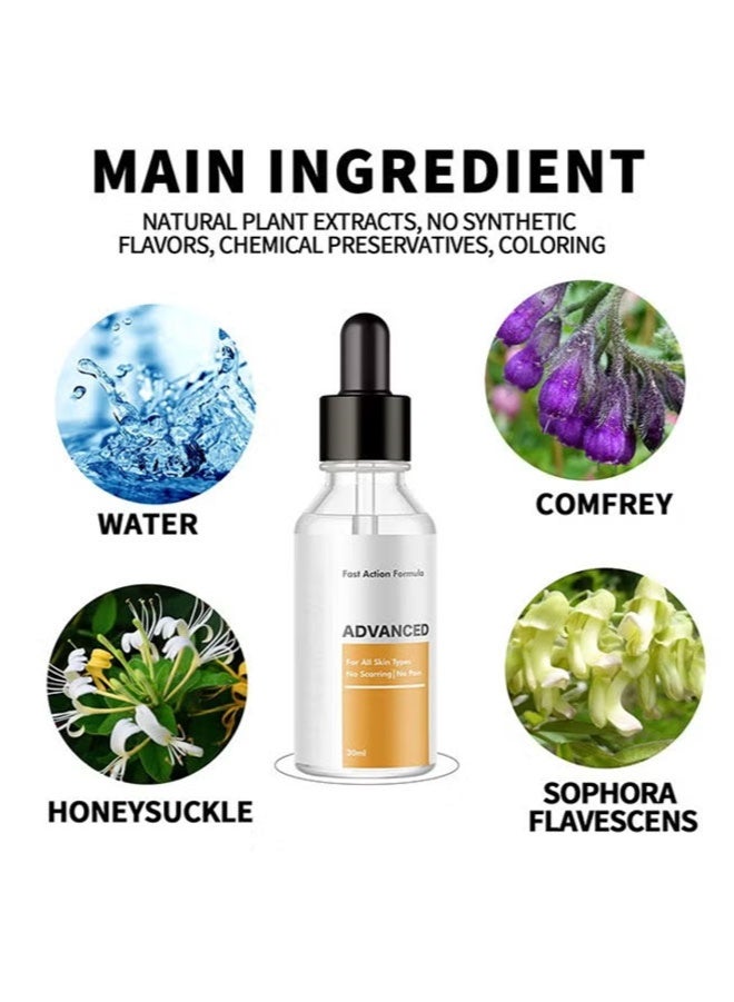 إيلهو مزيل الثآليل، إزالة سريعة المفعول للرجال والنساء، مناسب للثآليل الأخمصية، الثآليل الشائعة، الثآليل المسطحة، الذرة (قطعتان) - Image 5