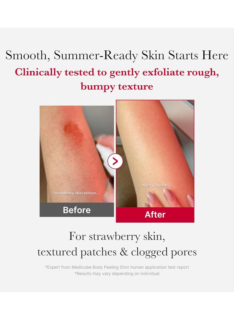 ميديكيوب جرعة تقشير الجسم من ميديكيوب ريد لعلاج حب الشباب، منظف بخاخ للجسم بنكهة الفراولة، حمض ألفا هيدروكسي + حمض بيتا هيدروكسي + حمض السكسينيك، مقشر، 3.88 أونصة. - Image 4