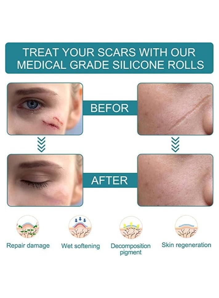 Elaimei Elaimei Silicone Scar Sheets Soft Silicone Gel Scar Tape Painless Silicone Tape Roll - Effective Silicone Scar Removal Strips Sheets for C-Section & Keloid Surgery, Burn, Acne  - Image 2