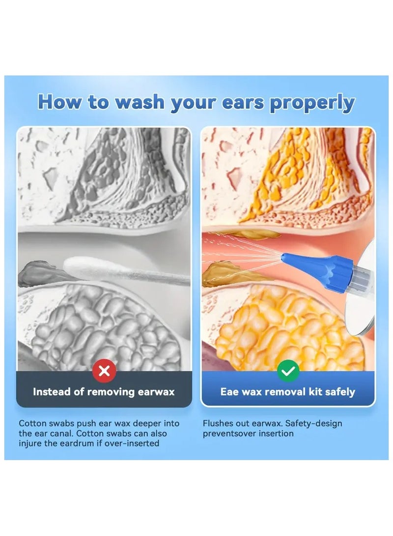 SYOSI Ear Wax Removal Tool Ear Cleaner Ear wax Removal Kit Manual Ear Irrigation Flushing System Ear Cleaning Washer Kit Safe and Effective to Clean Ear Built Up Wax for Adults - Image 3