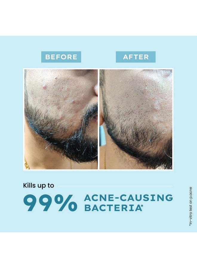 HYPHEN Acne Defence Daily Serum For Acne Prone Skin With Salicylic Acid 2% Azelaic Acid 10% Niacinamide 4% Treats Active Acne Controls Oil Antiacne Serum For Men & Women 30 Ml - Image 3