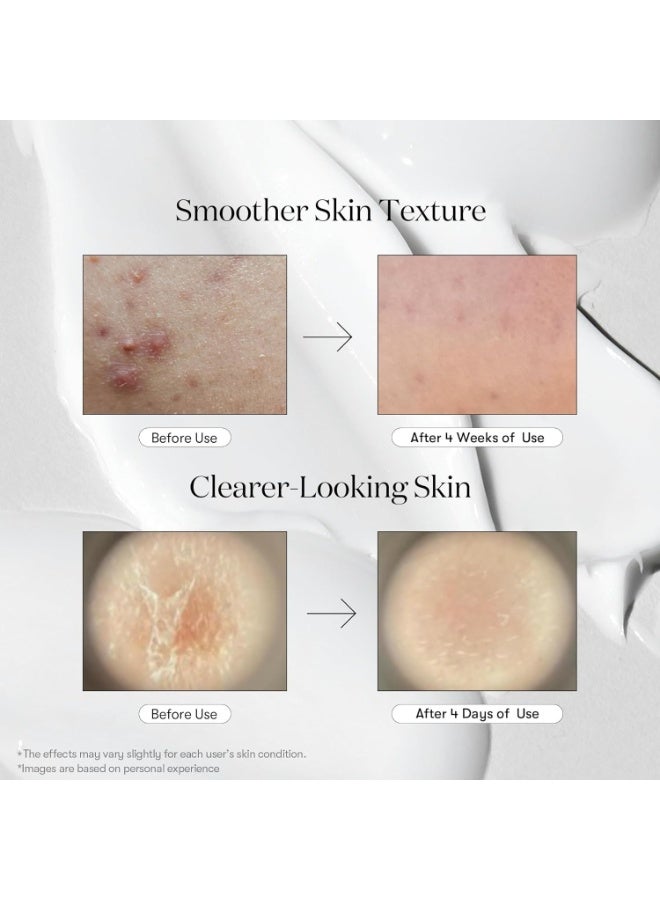 في تي كوزمتيكس كريم العناية بالبشرة ريدل شوت من في تي كوزماتيكس - Image 3