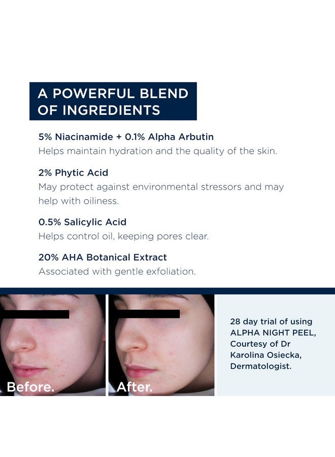 ALPHASCIENCE Alpha Night Peel Unifying Resurfacing Serum Helps Smooth Uneven Skin For Oily & Acne Prone Skin And Fine Lines And Wrinkles 30 Ml / 1 Fl. Oz. - Image 5