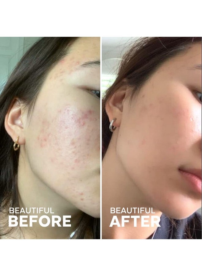 Three Ships Radiance Grape Stem Cell + Squalane Day Cream Vegan Facial Moisturizer Hydrates & Balances Skin As Seen On Tv Natural Face Lotion For All Skin Types 50G - Image 3