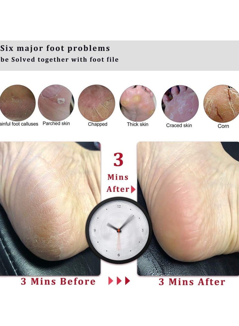INFLUX Professional Foot File Foot Scrubber Hard Skin Callus Remover Pedicure Foot Rasp,Can Be use on Cracked Heels,Dead Skin,Corn,Pumice Stone for Feet Massager Scraper File Brush Tools - Image 3