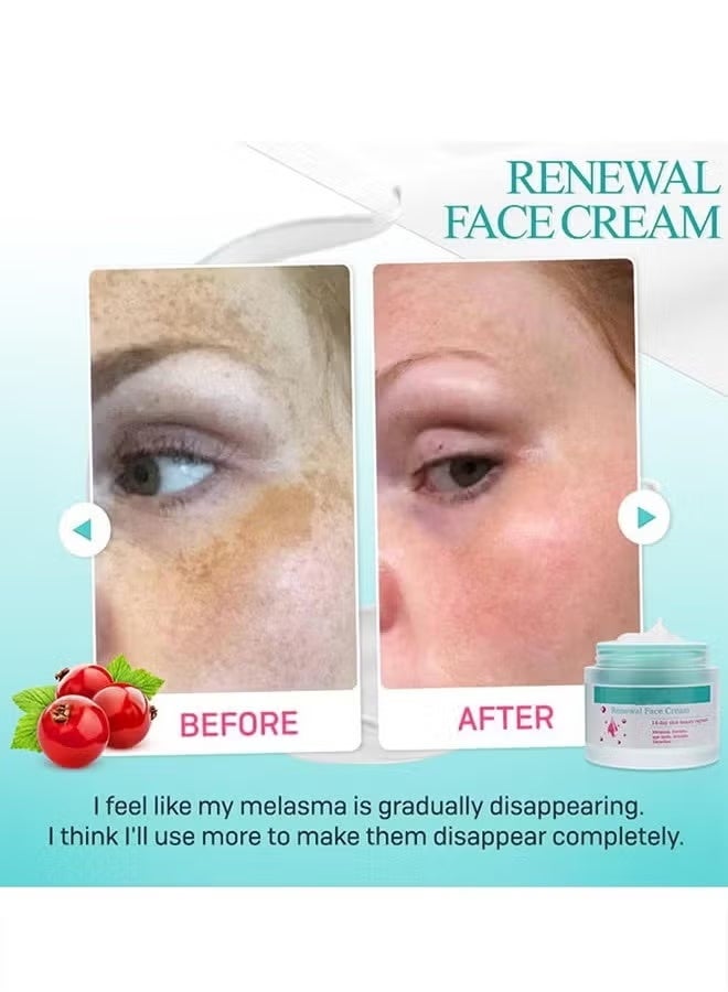 Renewal Face Cream 14Day Skin Beauty Regimen Melasma，Freckles Age Spots，Wrinkles Smoother ,Dark Spots Cream, for Melasma and Freckles Treatment for All Skin Types,Anti-wrinkle Face Cream, Korean - Image 4
