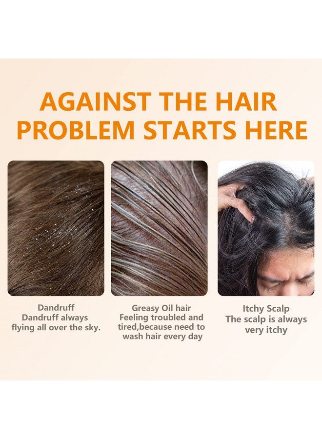 YAFUSIPE Shampoo Bar Turmeric Soap Bar Shampoo For Hair 2 Pack Clarifying Shampoo Bar Organic Ginger Bar Shampoo For Hair Growth Regrowth Natural Solid Shampoo Bars Dandruff Shampoo Bar For Thinning Hair Loss - Image 4