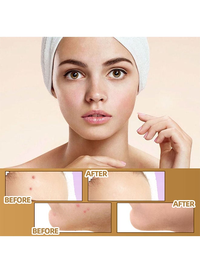 Jaysuing - Tatto Cover Up - Ultra-Thin Flaw Concealer Sticker Patch Skin Concealing Tape - Thin tattoo cover up tape for unisex - Tattoo Cover Up Makeup Waterproof for Covering Up Scars and Tattoo 10Pcs 60 patchs - Image 1
