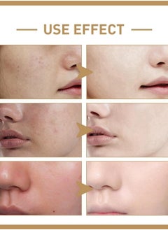 EELHOE Rice Toner Anti-aging Moisturizing Essential Toner Facial Skin Care Brighten Improve Fine Line  - Image 3