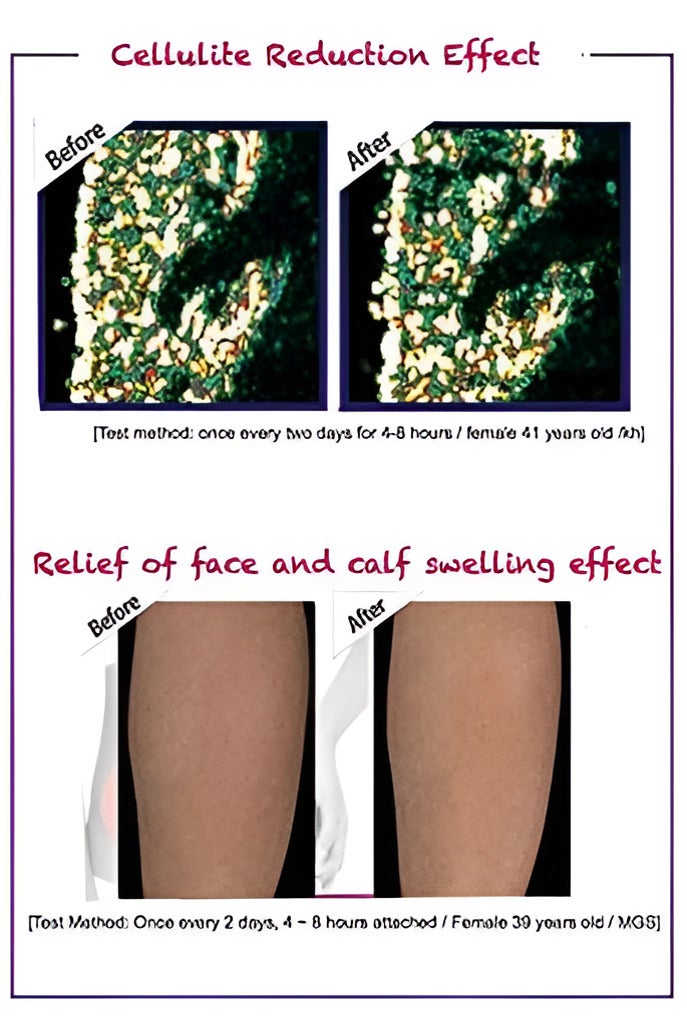 Abdominal Slimming Patch - Herbal Body Sculpting & Toning Solution - Image 4