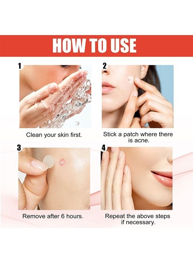 EELHOE 144 Pieces Hydrocolloid Acne Patche Set, 2 Sizes Acne Absorbing Cover Patch, Treatment Pimple Patch Set Clear  - Image 5