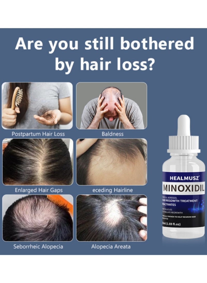 HEALMUSZ Minoxidil Hair Regrowth – Reactivate Follicles for Fuller Hair | 3.38 fl. oz (100 mL) Total | 2 Bottles (50 mL Each) - Image 3