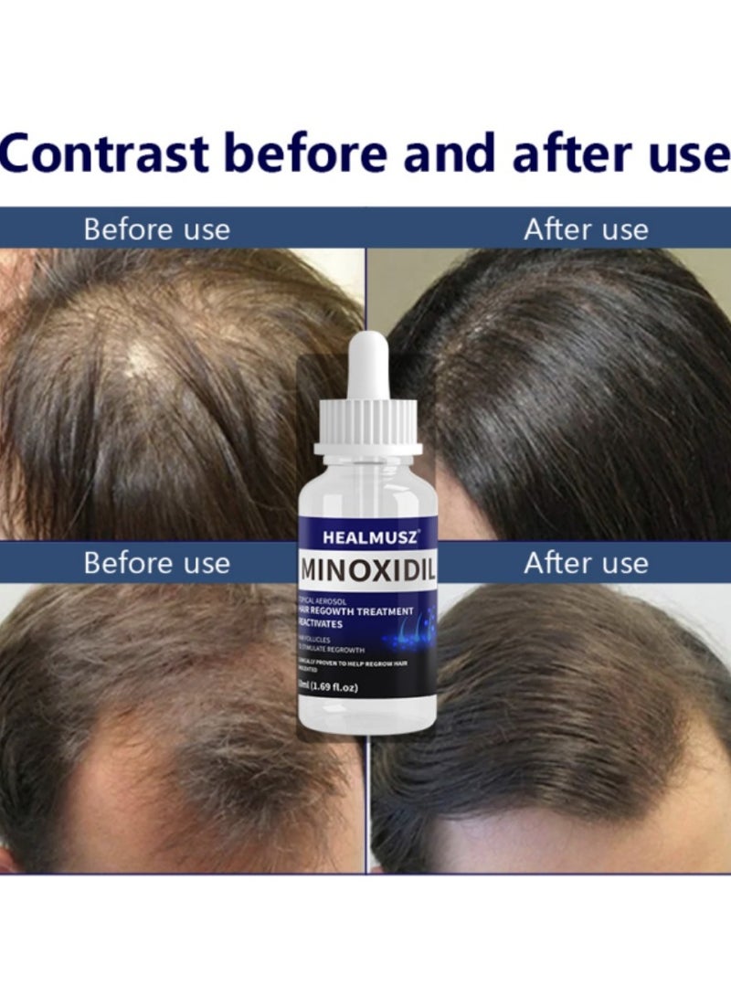HEALMUSZ Minoxidil Hair Regrowth – Reactivate Follicles for Fuller Hair | 3.38 fl. oz (100 mL) Total | 2 Bottles (50 mL Each) - Image 5