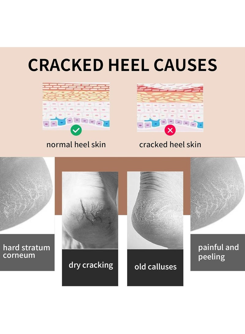 أوزيغالور 2 زوج من جوارب ترميم الكعب المتشقق - جل مرطب، مسامي ومريح، للكعوب الجافة والمتشققة والقاسية والخشنة - Image 5