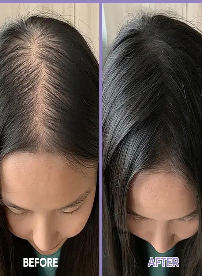 SPRING H2O Rosemary Hair Growth Conditioner 250ml - Natural Hair Loss Treatment with Organic Rosemary Oil & Biotin - Sulfate-Free, Deep Conditioner for Thicker, Fuller Hair - Reduces Breakage & Split Ends - Men & Women - Image 5