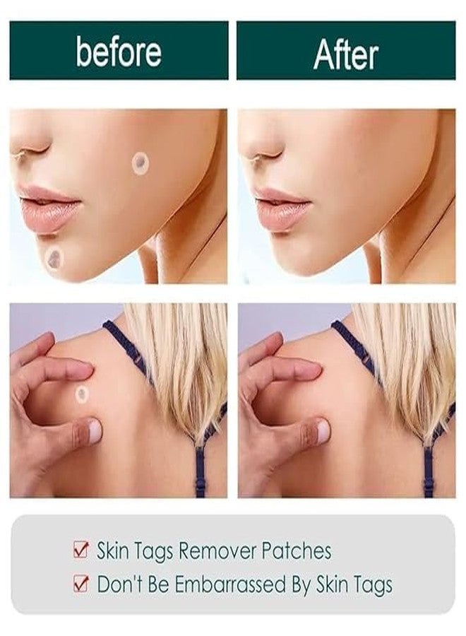 PEAKTASTE لصقات حب الشباب مع مادة الهيدروكولويد - ملصقات علاج موضعي غير مرئية ومقاومة للماء للبثور والشوائب - لصقات وجه سريعة الشفاء وغير مهيجة لإصلاح البشرة طوال الليل (36 قطعة) (شفافة) - Image 5