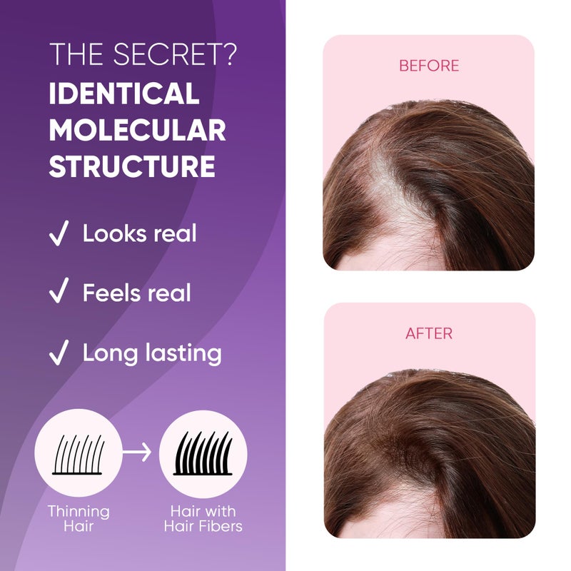 Get Back Gorgeous GBG Hair Fibers for Thinning Hair & Bald Spots (Medium Brown) - 25g Bottle - Conceals Hair Loss - Instant Cover Up & Volume in 30 Seconds, Hair Powder for Women & Men - Cruelty Free - Image 3