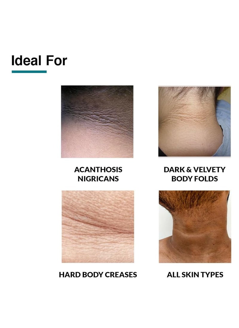 FIXDERMA Fixderma Nigrifix cream for Acanthosis Nigricans | Underarm Cream Effective for Armpit, Knees, Elbows & Knuckles | Dermatologist Tested - 3.52 OZ  - Image 3