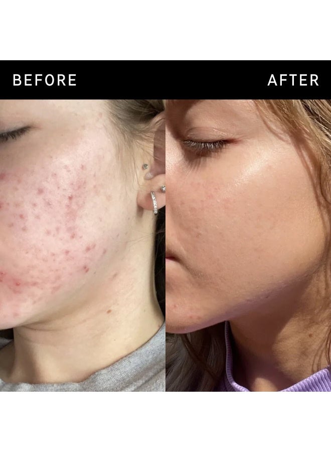 The Inkey List Niacinamide Serum - Image 4