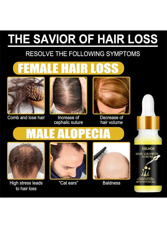 إيلهو زيت نمو الشعر ، مصل زيت نمو الشعر الطبيعي البيوتين لتحفيز إعادة نمو الشعر للحصول على شعر أكثر كثافة وقوة للرجال والنساء - Image 3