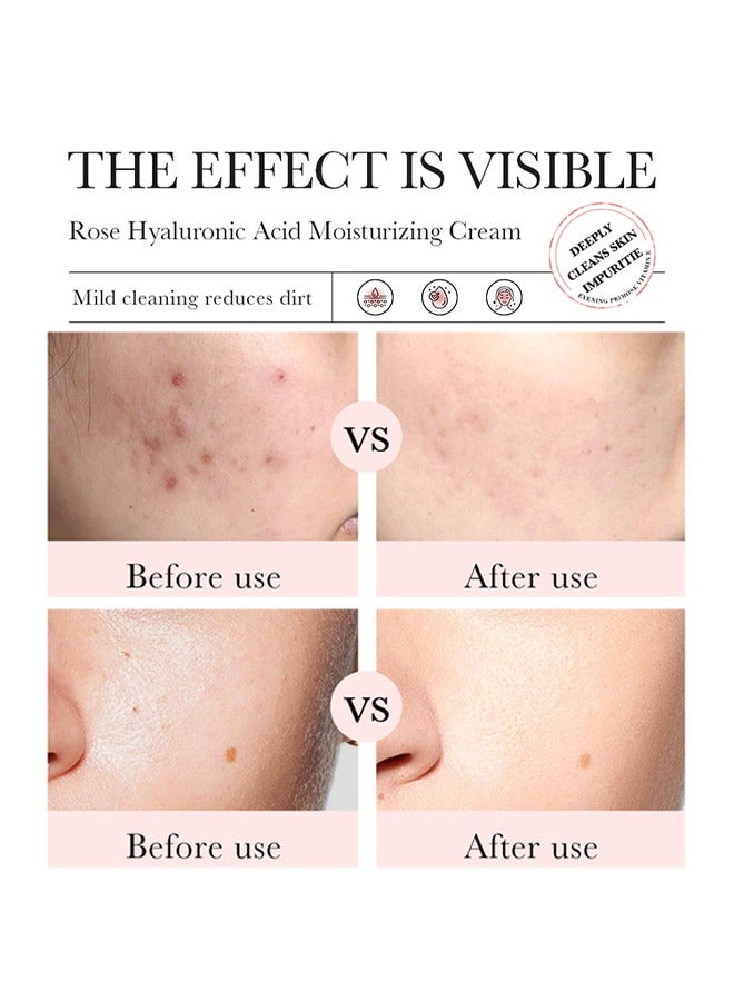 بيو أكوا حمض الهيالورونيك الوردي ، 98٪ مرطب جوهر ترطيب الوجه لترطيب المسام يتقلص المسام المضادة للأكسدة يغذي 30 مل - Image 4