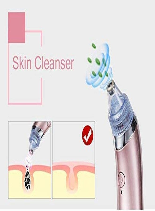 Credly Pore Spot Cleaner Vacuum Beauty Facial Skin Care Tool USB Rechargeable Blackhead Remover (multicolor) - Image 4