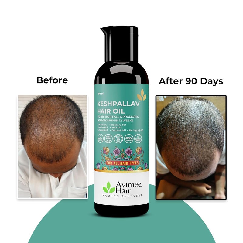 AVIMEE HERBAL مجموعة توفير سوبر لنمو الشعر من أفيمي كيشبالاف زيت الشعر 100 مل وسيروم نمو الشعر سكالب تون 25 مل - Image 3